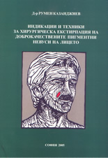 Индикации и техники за хирургическа екстирпация на доброкачествените пигментни невуси на лицето