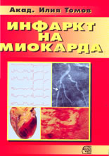 Инфаркт на миокарда